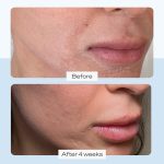 کرم آبرسان و ترمیم‌کننده First Aid Beauty Ultra Repair Cream | برای پوست خشک و حساس - تصویر 3